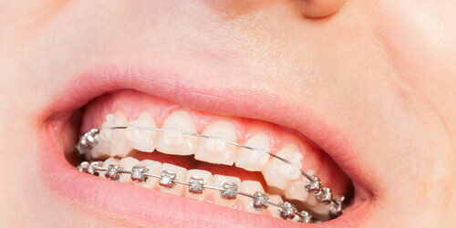 fotolia_131762460